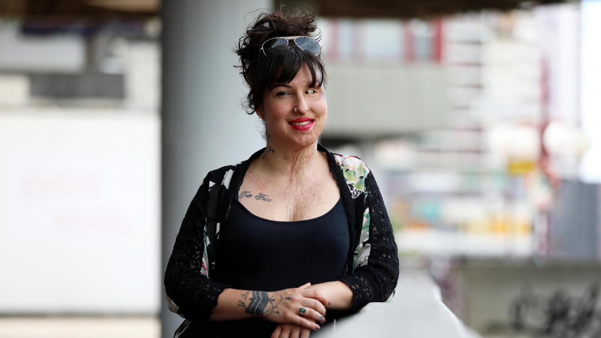 Zu sehen ist eine weiße Frau mit lockigen hochgesteckten dunklen Haaren, in denen eine Sonnenbrille steckt. Sie trägt ein schwarzes Kleid mit Jäckchen und hat rot geschminkte Lippen. Dekolletee und Handgelenk sind mit Tattoos verziert. Die rechte Gesichtshälfte der Frau ist bis ins Dekolletee hinunter vernarbt. Dort, wo sich das rechte Auge befinden sollte, trägt sie ein silbernes Implantat. Zu sehen ist eine weiße Frau mit lockigen hochgesteckten dunklen Haaren, in denen eine Sonnenbrille steckt. Sie trägt ein schwarzes Kleid mit Jäckchen und hat rot geschminkte Lippen. Dekolletee und Handgelenk sind mit Tattoos verziert. Die rechte Gesichtshälfte der Frau ist bis ins Dekolletee hinunter vernarbt. Dort, wo sich das rechte Auge befinden sollte, trägt sie ein silbernes Implantat.
