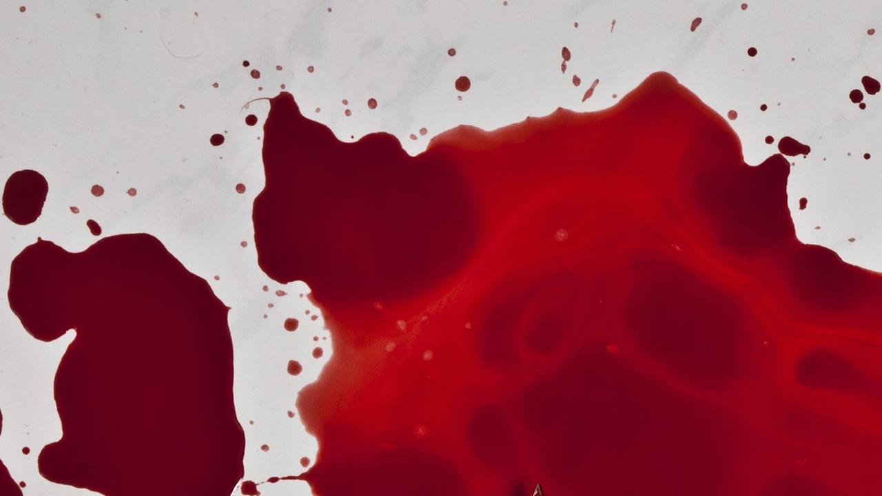 Blut auf weißer Fläche Blut auf weißer Fläche