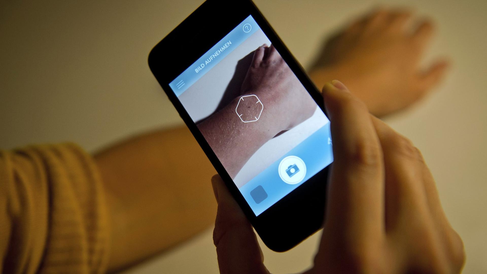 Eine Frau fotografiert mit der App "Goderma" ein Muttermal. Eine Frau fotografiert mit der App "Goderma" ein Muttermal.