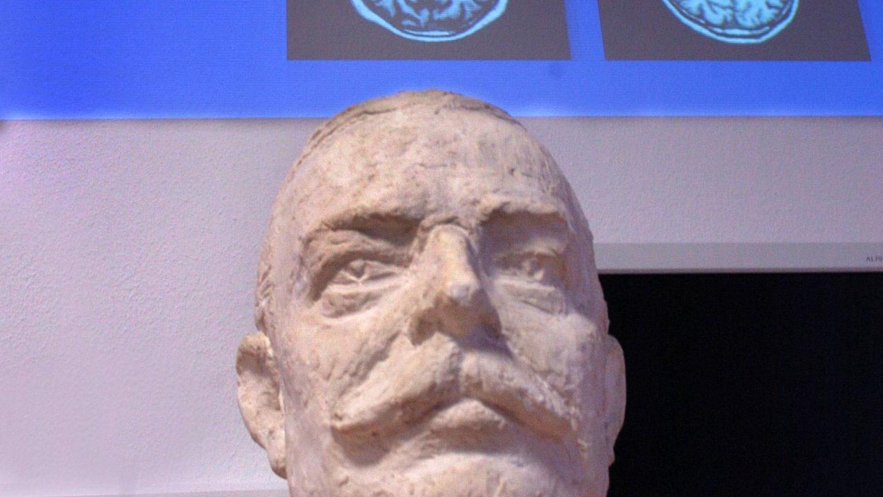 Büste von Alois Alzheimer Büste von Alois Alzheimer