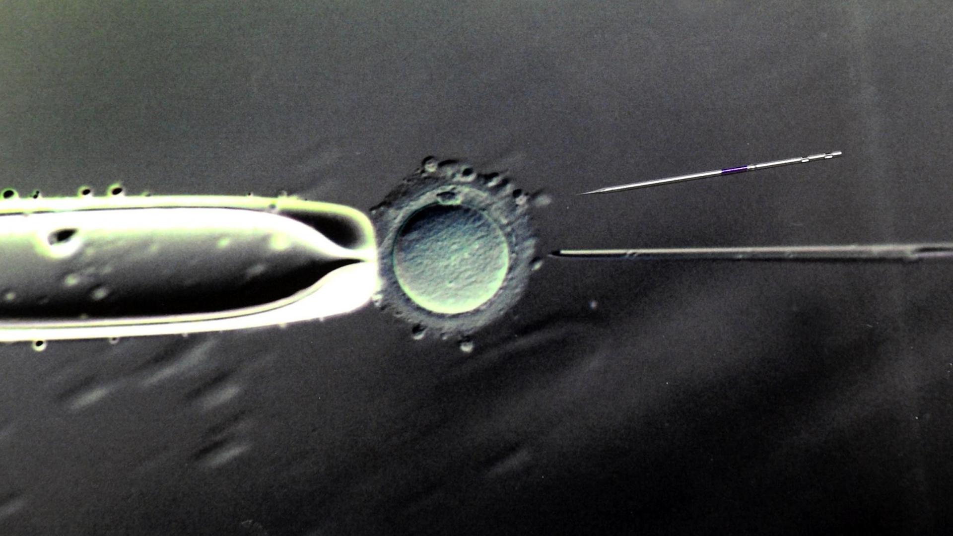 Im Biologischen Labor des Zentrums für Reproduktionsmedizin an der Universitätsfrauenklinik in Leipzig ist eine 80- bis 100-fache Vergrößerung der Befruchtung einer Eizelle mit einer Injektionspipette und eine darüber liegende Injektionspipette Im Biologischen Labor des Zentrums für Reproduktionsmedizin an der Universitätsfrauenklinik in Leipzig ist eine 80- bis 100-fache Vergrößerung der Befruchtung einer Eizelle mit einer Injektionspipette und eine darüber liegende Injektionspipette