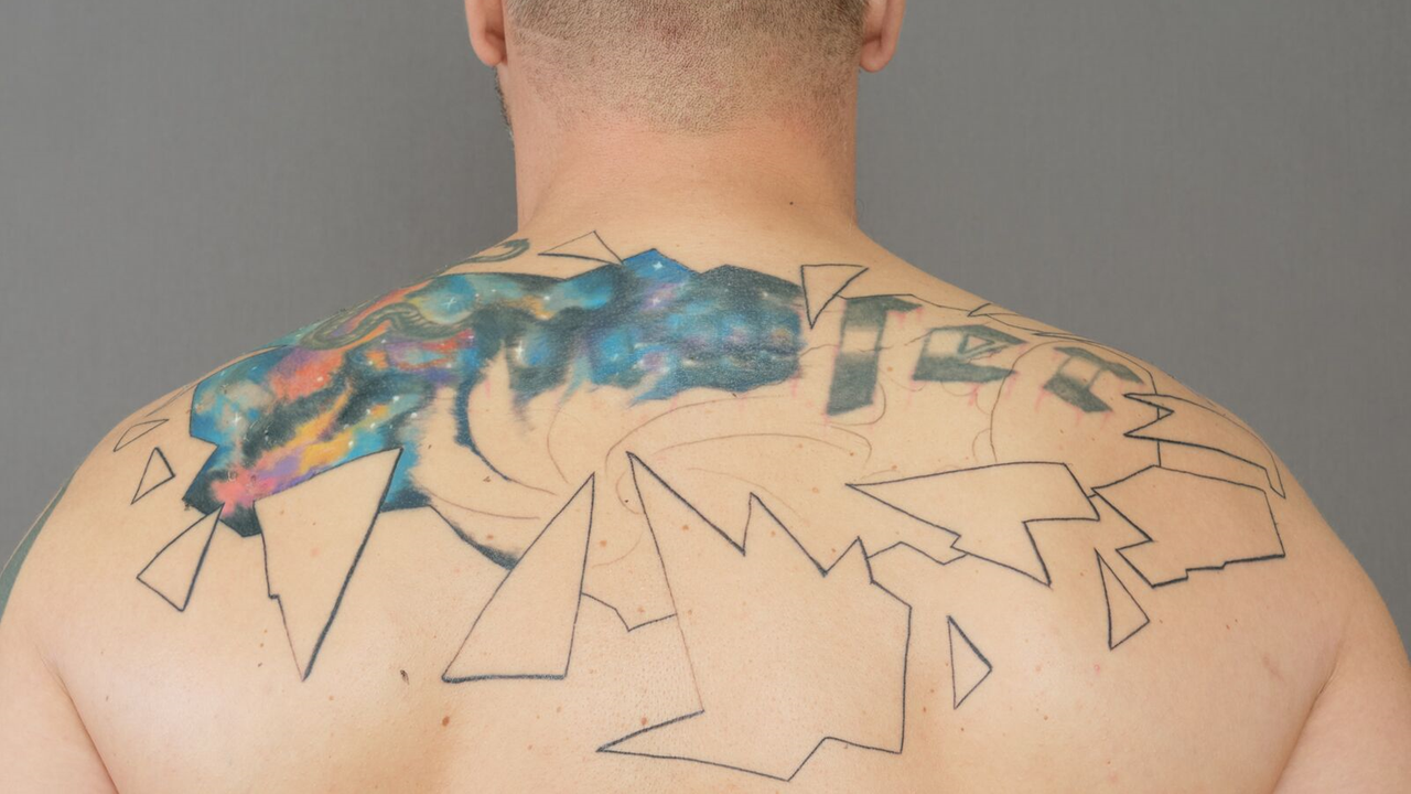 Frontalansicht eines männlichen Rückens, auf dem ein schon halb mit einem bunten Motiv überstochenes Nazitattoo prangt. Frontalansicht eines männlichen Rückens, auf dem ein schon halb mit einem bunten Motiv überstochenes Nazitattoo prangt.