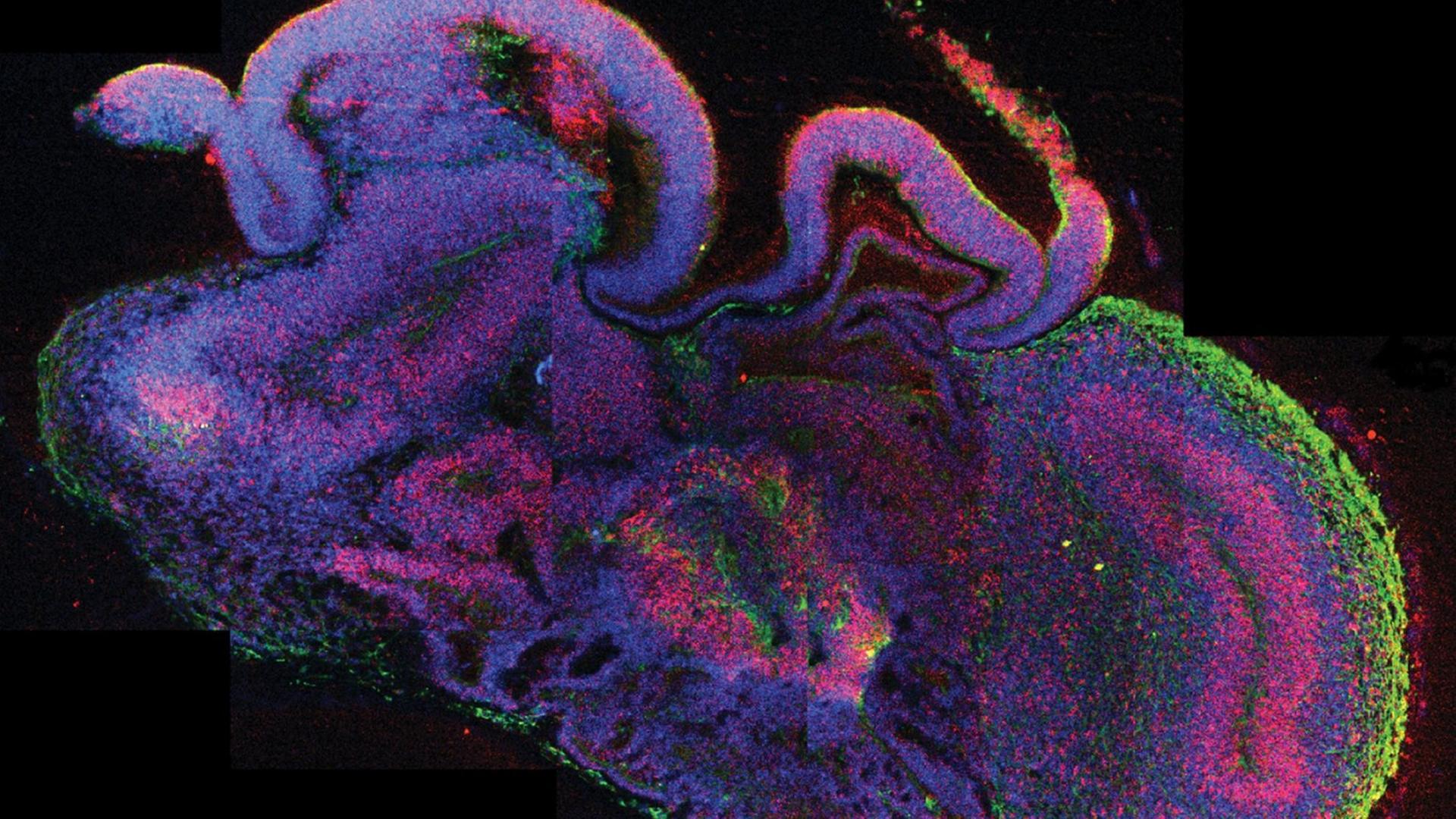 Die undatierte mikroskopische Querschnittsaufnahme eines ganzen cerebralen Organoids zeigt die Entstehung verschiedener Hirnregionen. Die etwa vier Millimeter großen dreidimensionalen Modelle bilden die frühe Entwicklung des menschlichen Gehirns nach. Ausgangspunkt für die Versuche eines waren zunächst embryonale Stammzellen. Die undatierte mikroskopische Querschnittsaufnahme eines ganzen cerebralen Organoids zeigt die Entstehung verschiedener Hirnregionen. Die etwa vier Millimeter großen dreidimensionalen Modelle bilden die frühe Entwicklung des menschlichen Gehirns nach. Ausgangspunkt für die Versuche eines waren zunächst embryonale Stammzellen.