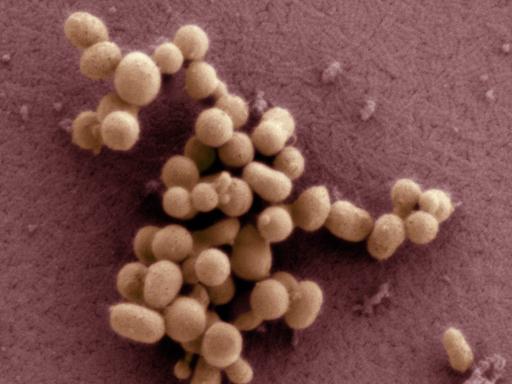 Sensation im Mai 2010: Craig Venter präsentierte ein kleines Bakterium, dessen Erbmaterial vollständig im Labor zusammengebaut wurde.