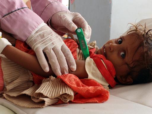 Ein Mitarbeiter von Ärzte ohne Grenzen behandelt im Jemen ein Kind, das mit Verdacht auf Cholera ins Krankenhaus kam
