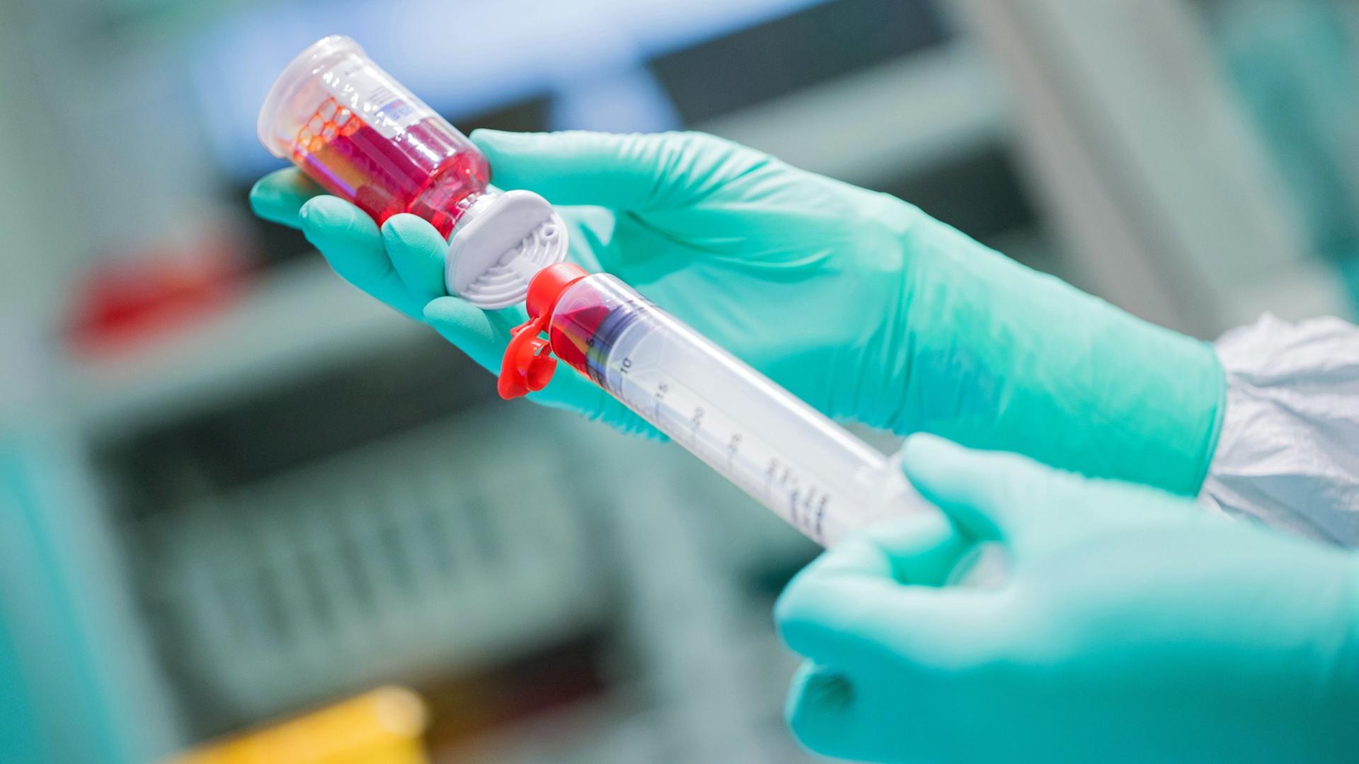 Ein Mitarbeiter in einem Labor einer Apotheke stellt mit grünen Gummihandschuhen Krebsmedikamente (Zytostatika) Ein Mitarbeiter in einem Labor einer Apotheke stellt mit grünen Gummihandschuhen Krebsmedikamente (Zytostatika)