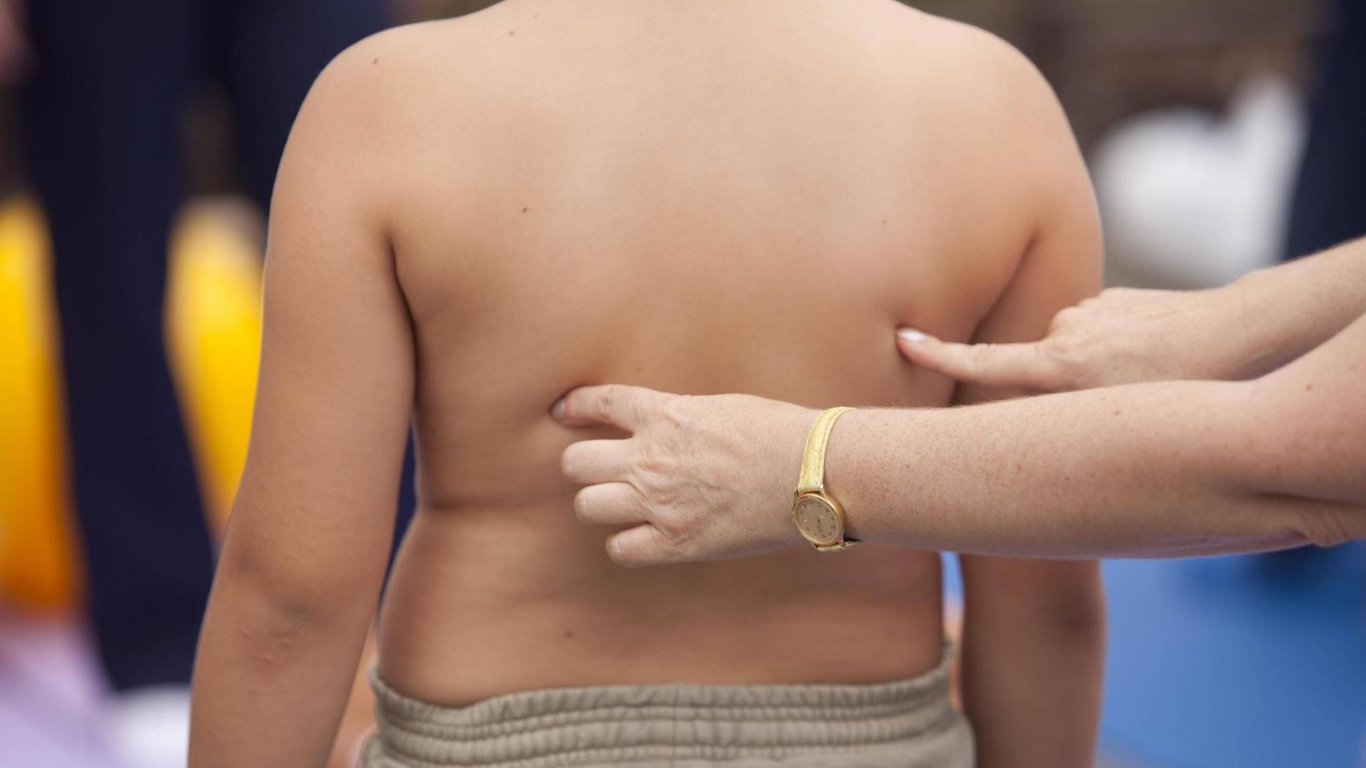 Rücken eines Jungen. Ein Mediziner betastet diesen. Rücken eines Jungen. Ein Mediziner betastet diesen.