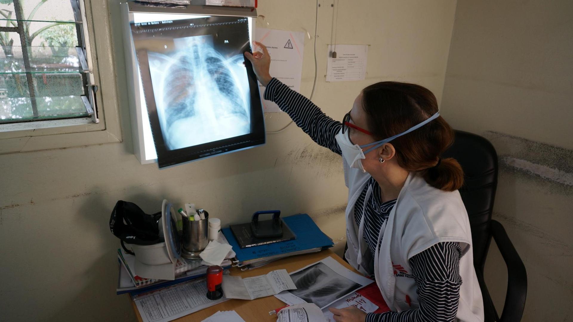 Die Internistin Miriam Arago Galindo vom Tuberkulose-Projekt von "Ärzte ohne Grenzen" in Mozambik analysiert eine Röntgenaufnahme vom Brustkorb eines Patienten. Die Internistin Miriam Arago Galindo vom Tuberkulose-Projekt von "Ärzte ohne Grenzen" in Mozambik analysiert eine Röntgenaufnahme vom Brustkorb eines Patienten.