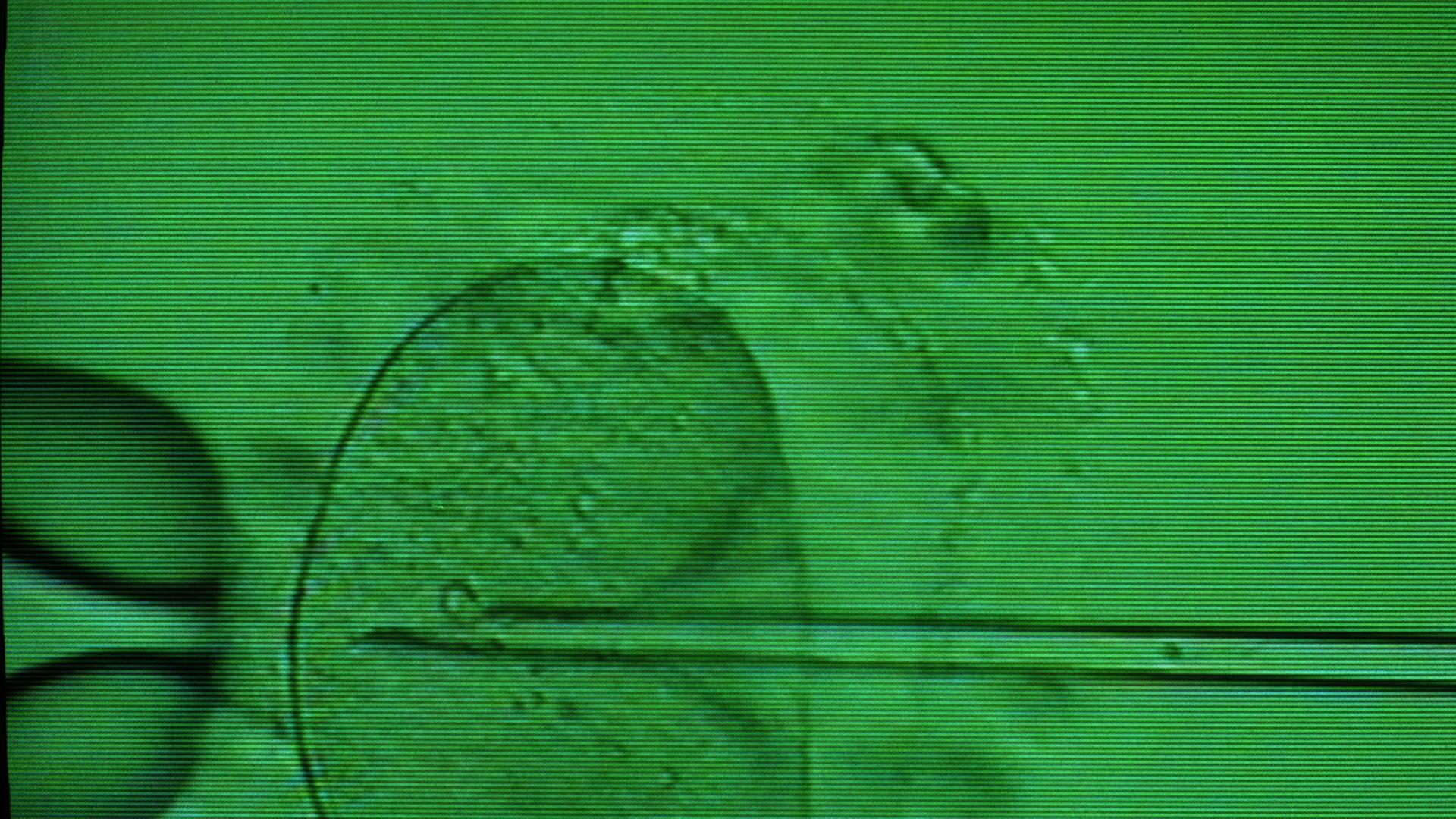 Das Monitorfoto zeigt das Einbringen einer Samenzelle in eine Eizelle mittels Mikropipette unter dem Mikroskop. Das Monitorfoto zeigt das Einbringen einer Samenzelle in eine Eizelle mittels Mikropipette unter dem Mikroskop.