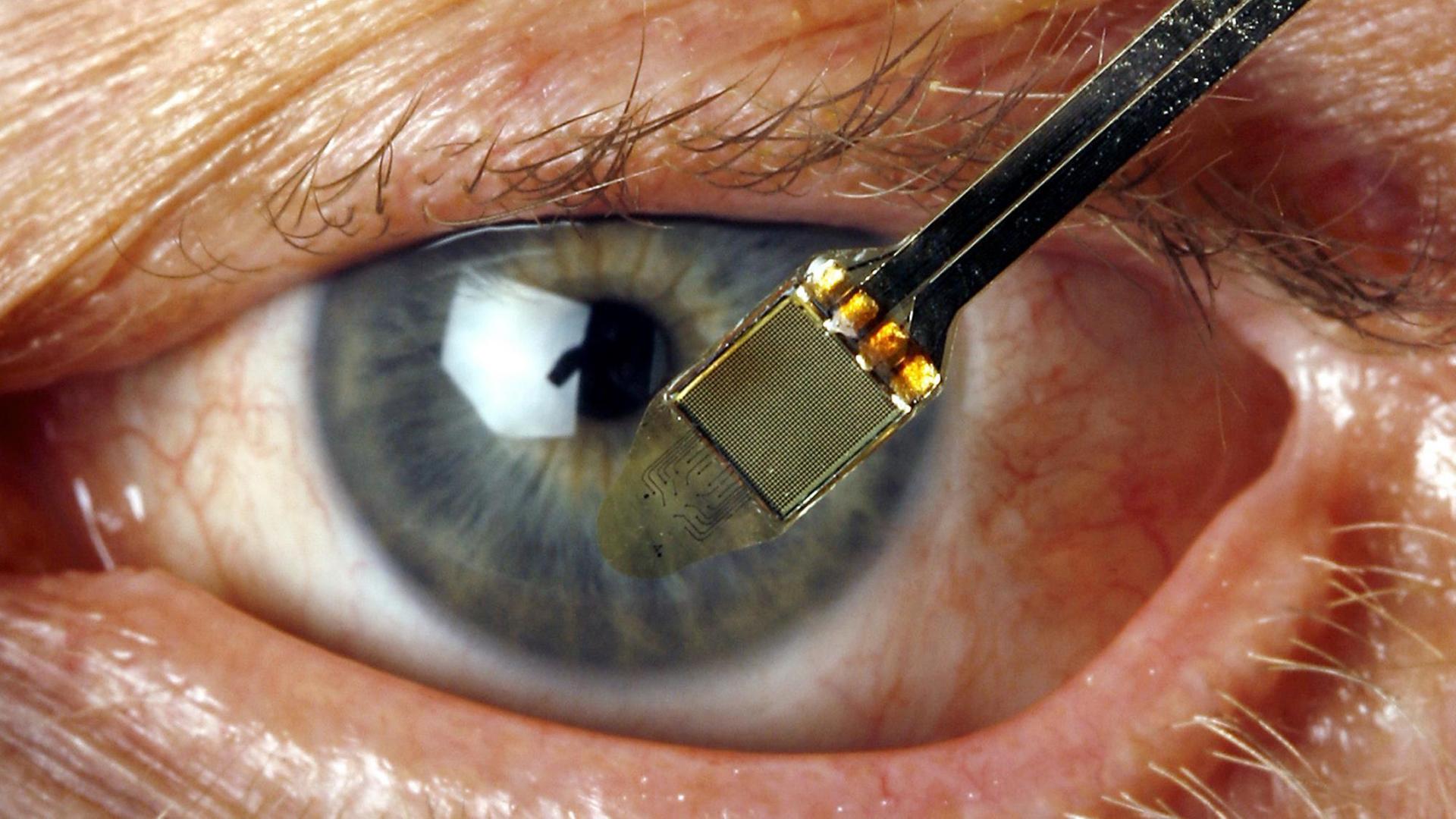 Eine Person hält am Dienstag in der Universitätsklinik Tübingen einen Chip vor das Auge des blinden Hartwig Lahann, der Ende 2006 für fünf Wochen einen baugleichen Chip in sein Auge implantieren ließ. Eine Person hält am Dienstag in der Universitätsklinik Tübingen einen Chip vor das Auge des blinden Hartwig Lahann, der Ende 2006 für fünf Wochen einen baugleichen Chip in sein Auge implantieren ließ.