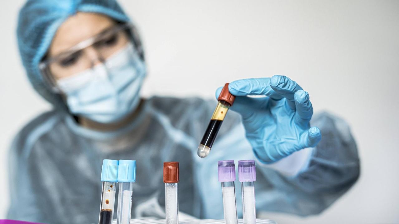 Blood test tube with label of Covid-19 also known as coronavirus or novel corona in scientist hand in laboratory. Female scientist is wearing highly protective suit, gloves, mask and glasses. Madrid, Community of Madrid, Spain PUBLICATIONxINxGERxSUIxAUTxONLY CR_JFOMNK210106B-595792-01 ,model released, Symbolfoto Blood test tube with label of Covid-19 also known as coronavirus or novel corona in scientist hand in laboratory. Female scientist is wearing highly protective suit, gloves, mask and glasses. Madrid, Community of Madrid, Spain PUBLICATIONxINxGERxSUIxAUTxONLY CR_JFOMNK210106B-595792-01 ,model released, Symbolfoto