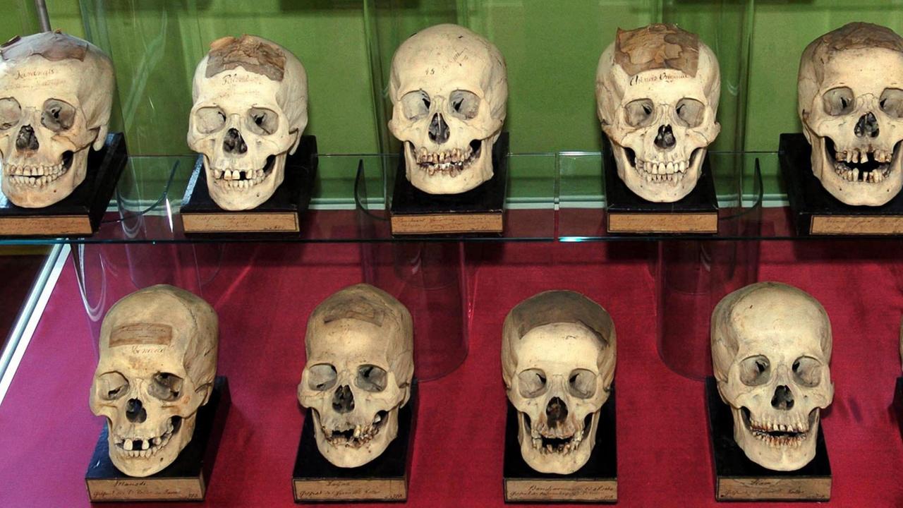 Menschliche Schädel in der historischen anatomischen Sammlung des Museums der Natur in Gotha. Menschliche Schädel in der historischen anatomischen Sammlung des Museums der Natur in Gotha.
