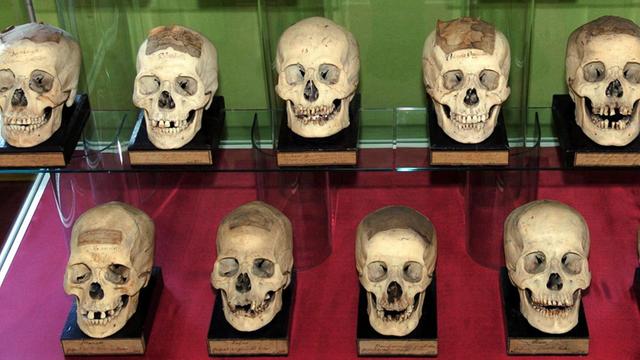 Menschliche Schädel in der historischen anatomischen Sammlung des Museums der Natur in Gotha.
