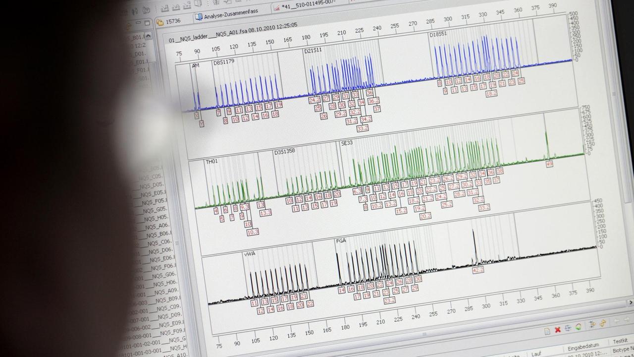 Eine DNA-Analyse ist am Freitag (08.10.2010) im neuen Amtssitz des Landeskriminalamts Nordrhein-Westfalen in Düsseldorf auf einem Monitor zu sehen. Eine DNA-Analyse ist am Freitag (08.10.2010) im neuen Amtssitz des Landeskriminalamts Nordrhein-Westfalen in Düsseldorf auf einem Monitor zu sehen.