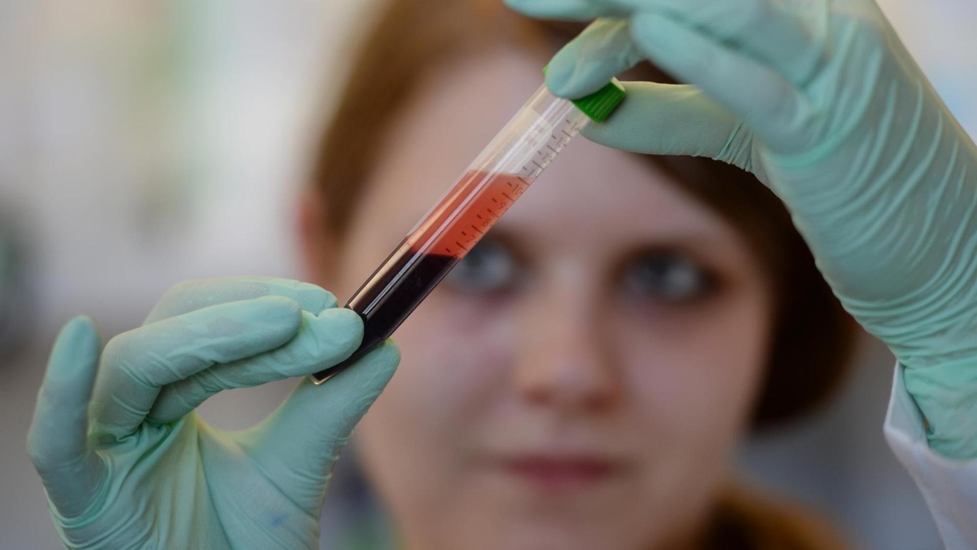Bei der Firma Lifecodexx wird die Blutprobe einer schwangeren Frau von einer medizinisch-technischen Assistentin analysiert. Das Unternehmen hat den "PraenaTest" entwickelt. Bei der Firma Lifecodexx wird die Blutprobe einer schwangeren Frau von einer medizinisch-technischen Assistentin analysiert. Das Unternehmen hat den "PraenaTest" entwickelt.