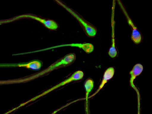Männliche Samenzellen unter dem Mikroskop.