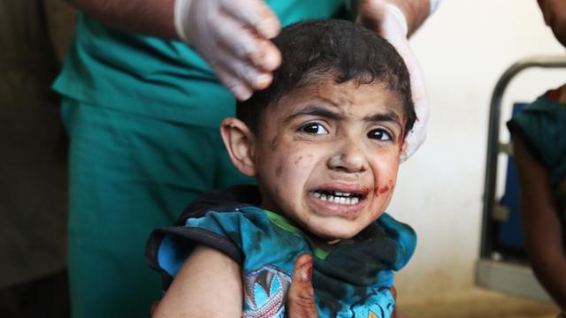 Ein Kind wird nach dem Luftangriff in Maaret al-Numan (Syrien) in einer Behelfsklinik behandelt.