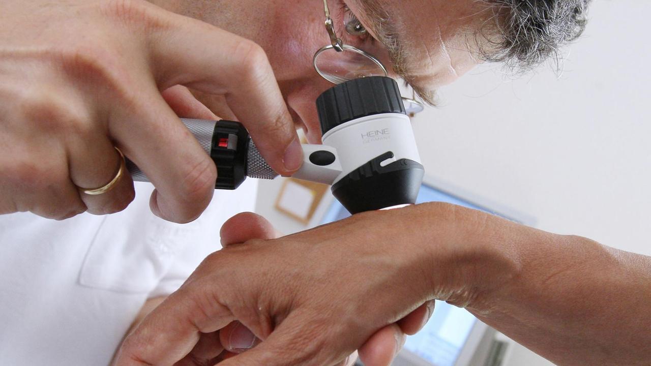 Ein Hautarzt untersucht am in seiner Praxis mit einem Vergrößerungsglas die Haut einer Patientin bei einer Hautkrebs-Früherkennung. Künstliche Intelligenz konnte, einer Studie zufolge, unter bestimmten Testbedingungen Hautkrebs besser diagnostizieren als Dermatologen Ein Hautarzt untersucht am in seiner Praxis mit einem Vergrößerungsglas die Haut einer Patientin bei einer Hautkrebs-Früherkennung. Künstliche Intelligenz konnte, einer Studie zufolge, unter bestimmten Testbedingungen Hautkrebs besser diagnostizieren als Dermatologen