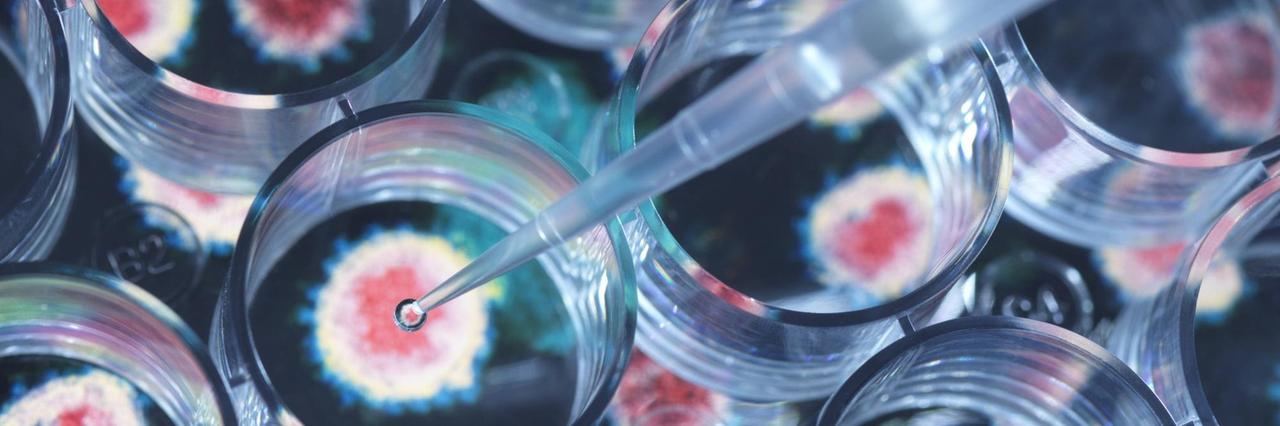 Nahaufnahme einer Pipette, mit der ein Testimpfstoff platziert wird. Nahaufnahme einer Pipette, mit der ein Testimpfstoff platziert wird.