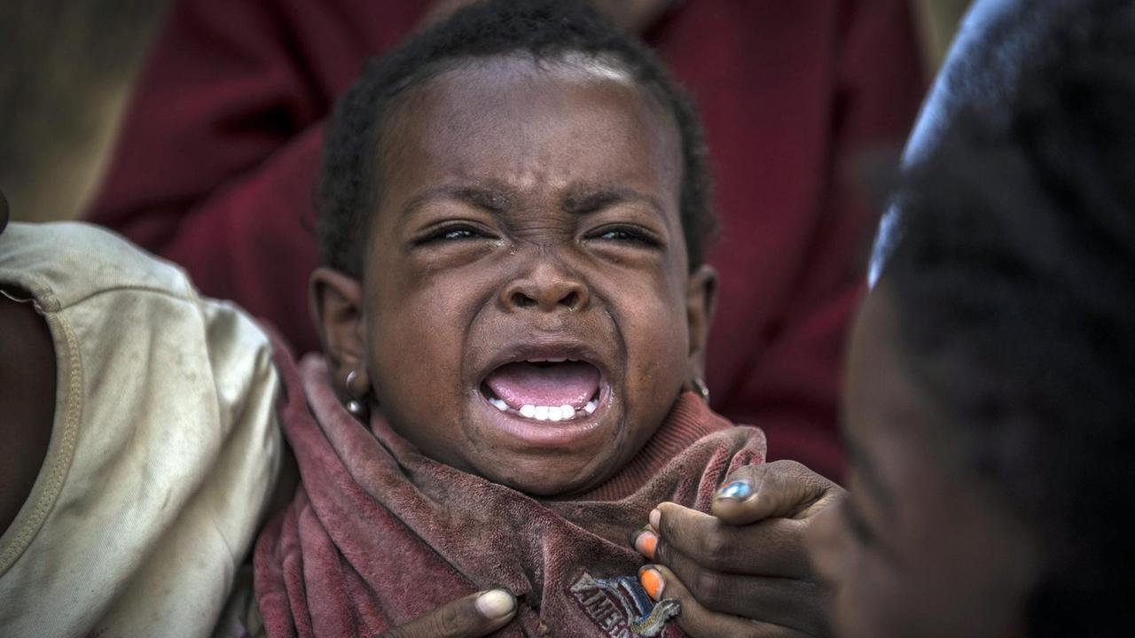 Ein kleines Mädchen im afrikanischen Madagaskar weint. Das Land hat eine der höchsten Geburtenrate der Welt. Mehr als drei Viertel der Bevölkerung leben in extremer Armut.