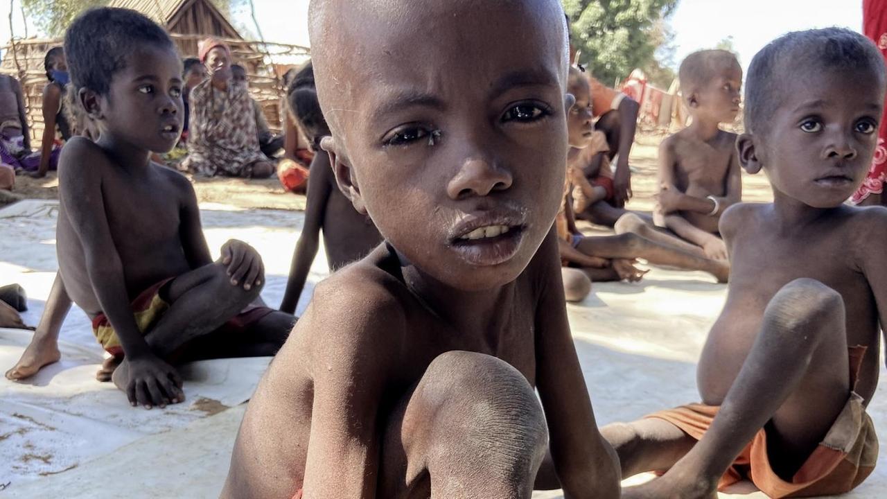 Sehr dünne Kinder in Madagaskar. Sehr dünne Kinder in Madagaskar.