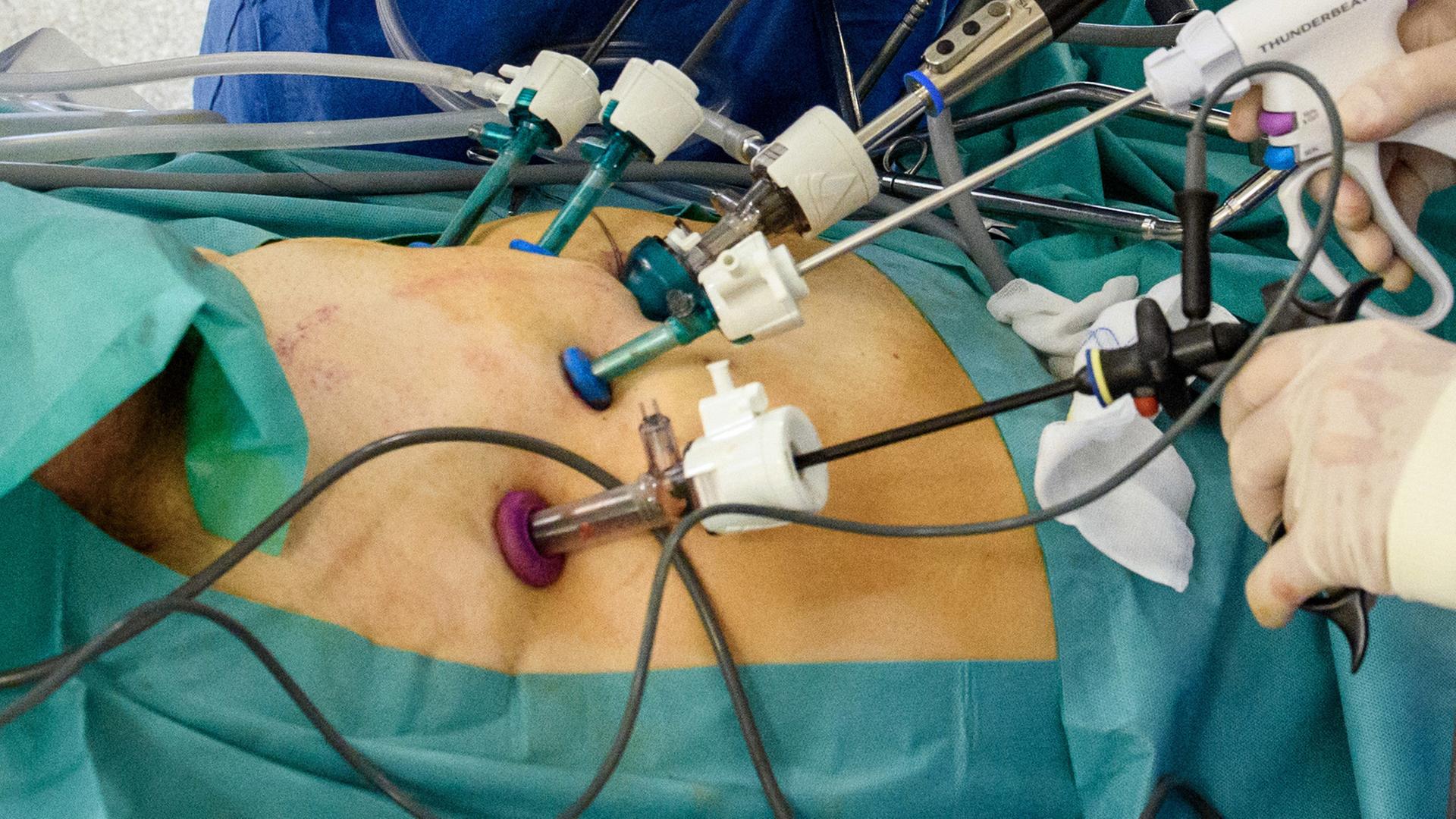 Untersuchungsgeräte angesetzt in einer Arztpraxis bei einem Patienten am Bauch Untersuchungsgeräte angesetzt in einer Arztpraxis bei einem Patienten am Bauch