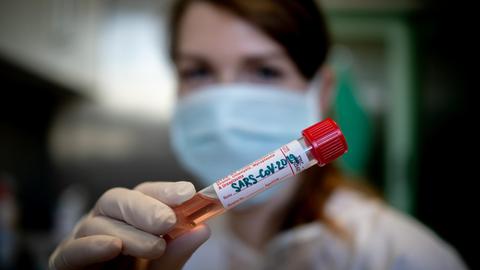 Laboruntersuchung von SARS-CoV-2 in einem tschechischen Labor in . Eine medizinische Mitarbeiterin hält eine Blutprobe in die Kamera.