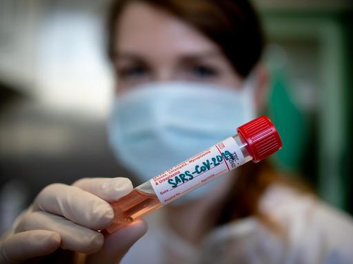 Laboruntersuchung von SARS-CoV-2 in einem tschechischen Labor in . Eine medizinische Mitarbeiterin hält eine Blutprobe in die Kamera.