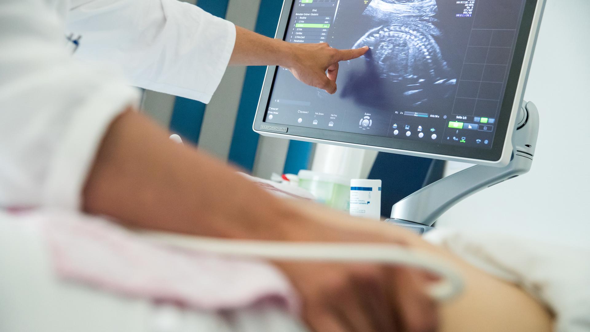 Ultraschalluntersuchung bei einer Schwangeren Ultraschalluntersuchung bei einer Schwangeren