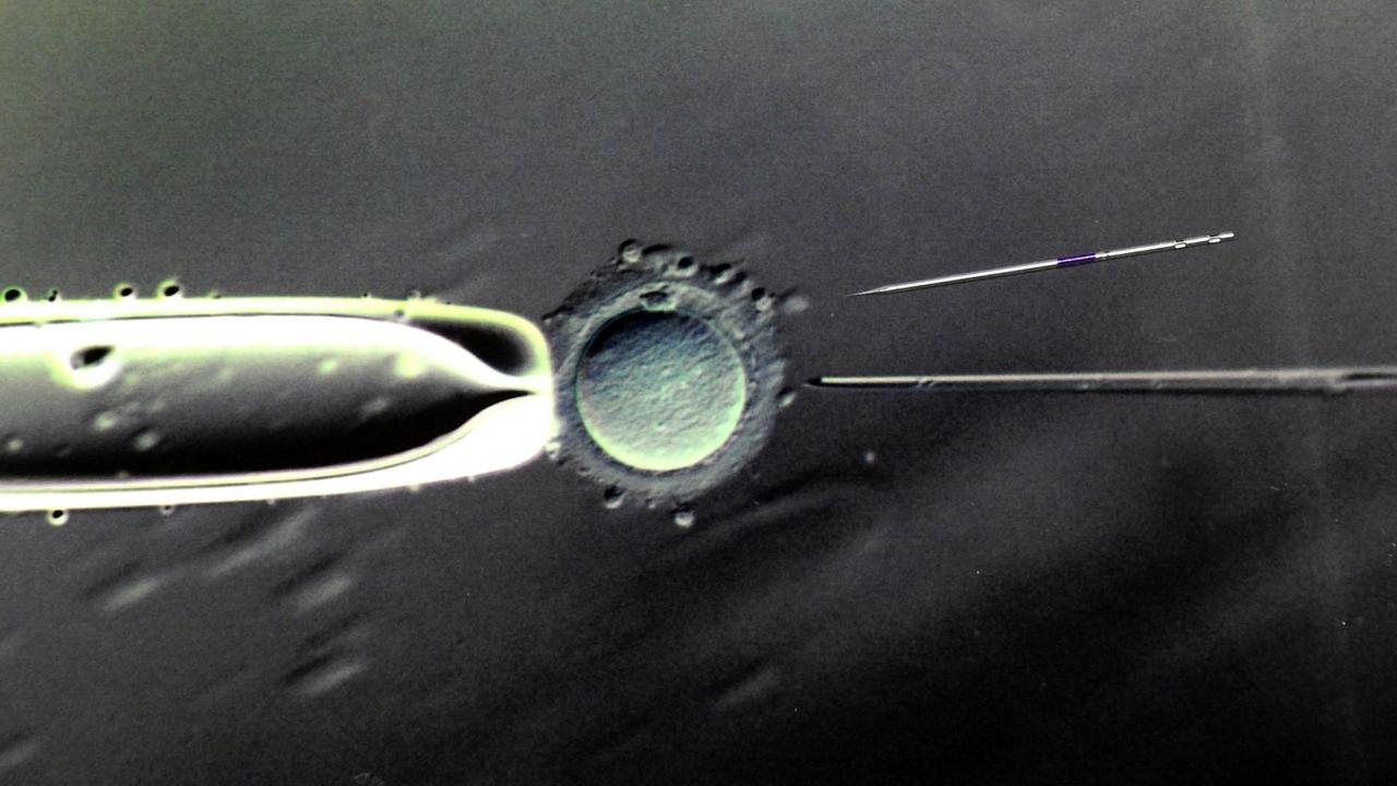 Im Biologischen Labor des Zentrums für Reproduktionsmedizin an der Universitätsfrauenklinik in Leipzig ist eine 80- bis 100-fache Vergrößerung der Befruchtung einer Eizelle mit einer Injektionspipette und eine darüber liegende Injektionspipette Im Biologischen Labor des Zentrums für Reproduktionsmedizin an der Universitätsfrauenklinik in Leipzig ist eine 80- bis 100-fache Vergrößerung der Befruchtung einer Eizelle mit einer Injektionspipette und eine darüber liegende Injektionspipette