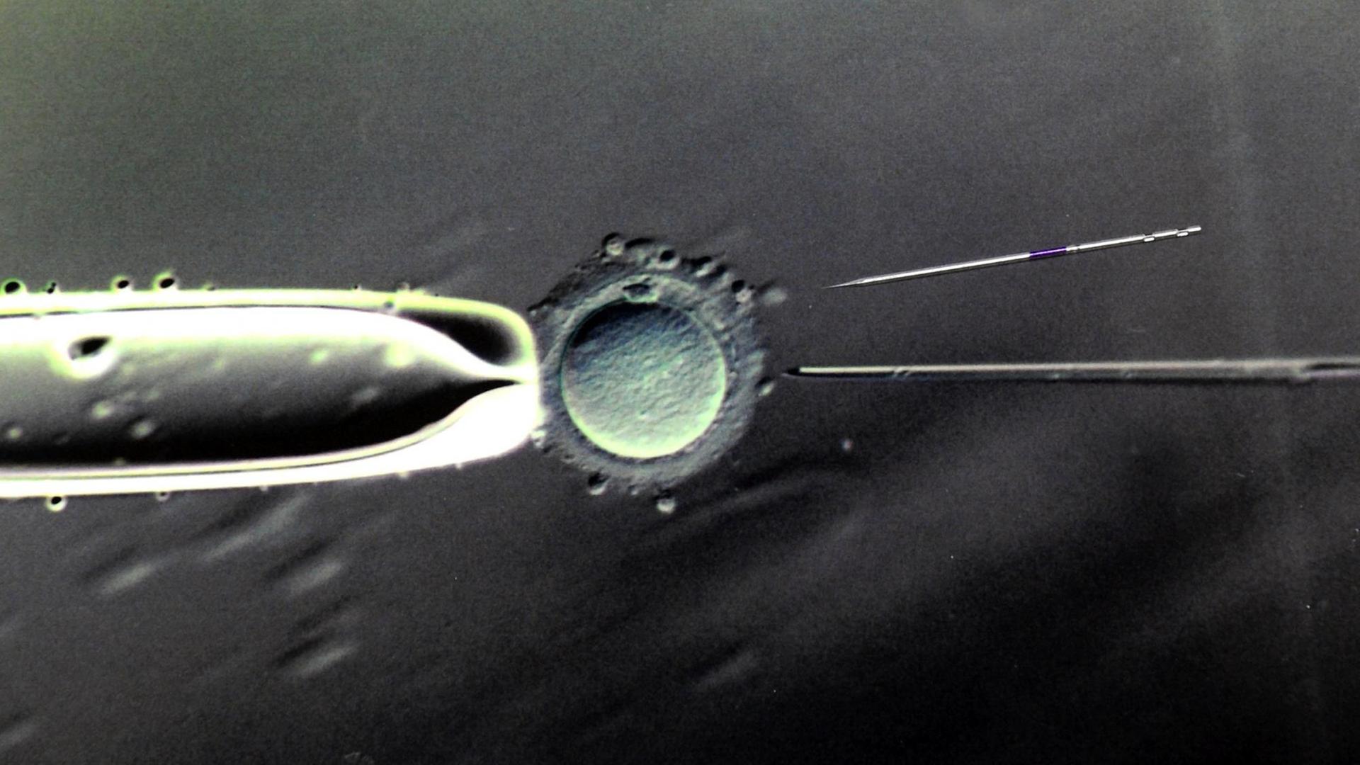 Befruchtung einer Eizelle mit einer Injektionspipette
