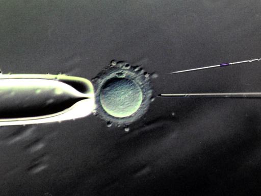 Befruchtung einer Eizelle mit einer Injektionspipette