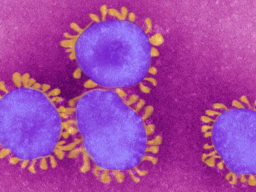 Zu sehen sind vier eingefärbte Viren - lila Kreise mit gelblichen Strichen rundherum auf pinkem Hintergrund.