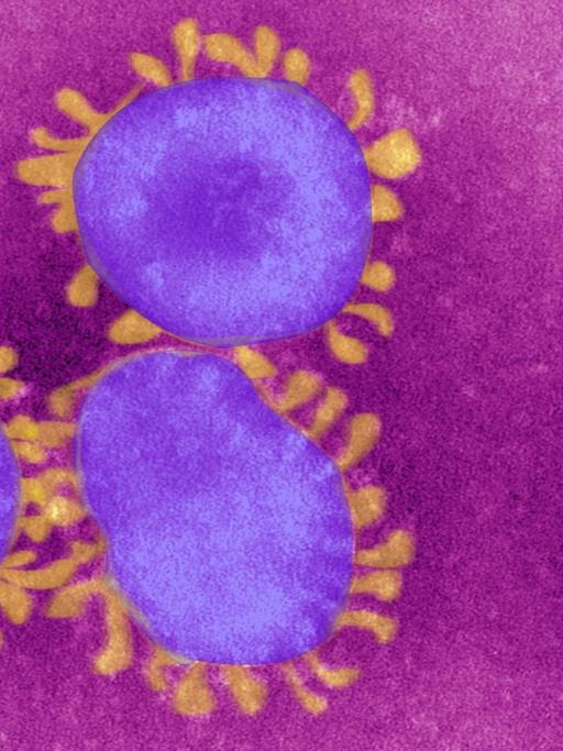 Zu sehen sind vier eingefärbte Viren - lila Kreise mit gelblichen Strichen rundherum auf pinkem Hintergrund.