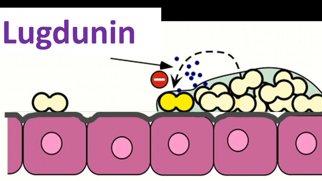 Auf den nasalen Epithelzellen (rosa) lebt das Bakterium Staphylococcus lugdunensis (weiß), das den Erreger Staphylococcus aureus (gelb) durch Bildung von "Lugdunin" abtötet.