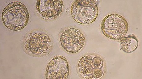 Die undatierte, von der Universität in Seoul, Südkorea, zur Verfügung gestellte Mikroskopaufnahme zeigt geklonte Embryonen im achtzelligen Stadium