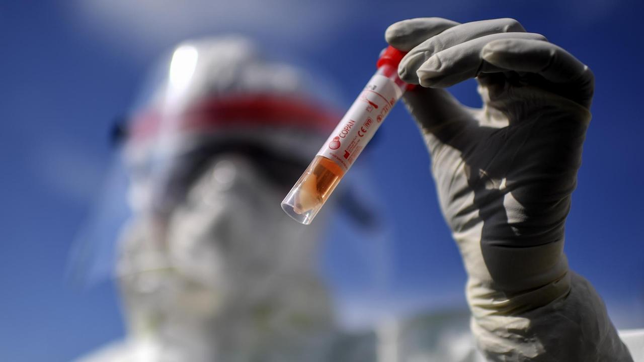 Ein Arzt eines hält in Schutzkleidung ein Reagenzglas für Personen, die den Test auf das Coronavirus COVID-19 durchführen müssen. Ein Arzt eines hält in Schutzkleidung ein Reagenzglas für Personen, die den Test auf das Coronavirus COVID-19 durchführen müssen.