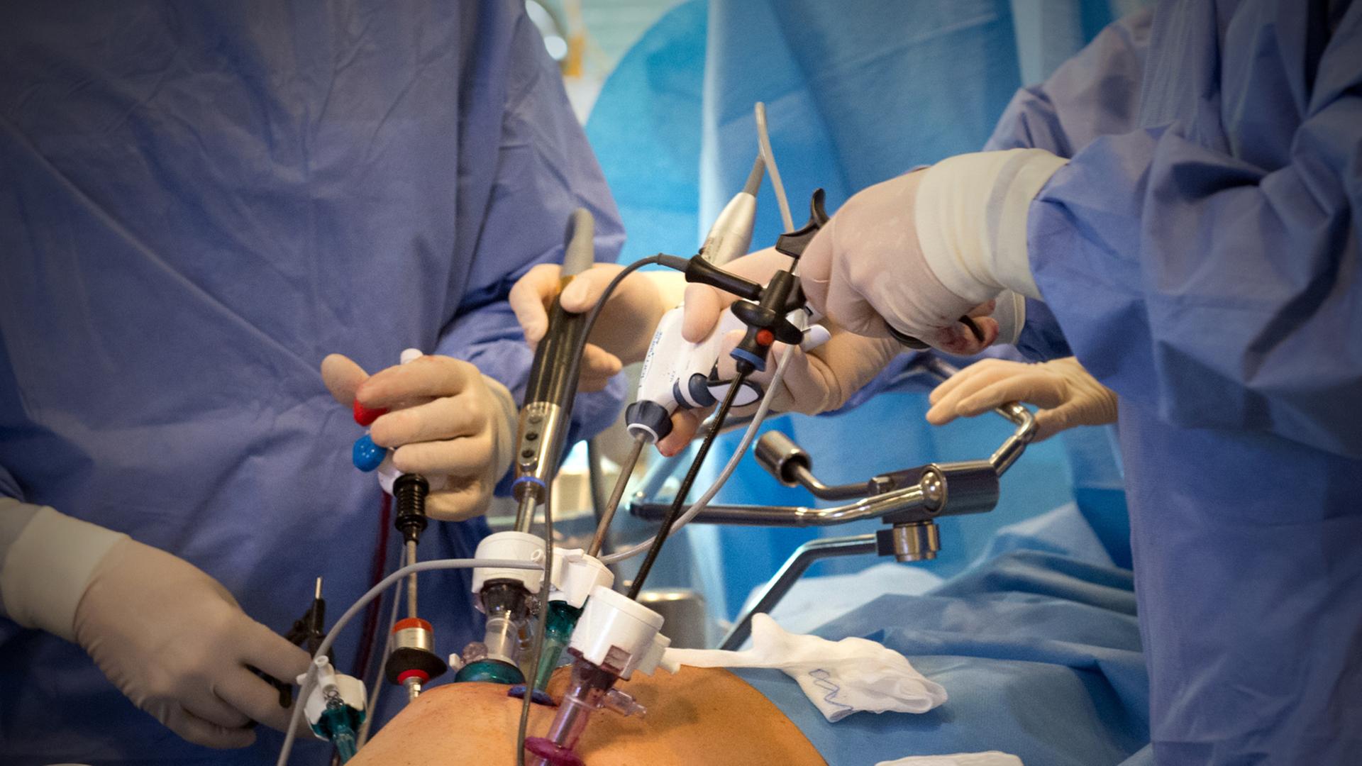 Blick auf einen Operationstisch, auf dem ein Patient liegt, dessen Prostatabereich zu sehen ist. Um in herum drei in blaue Kittel gekleidetes Krankenhaus-/Operationspersonal mit Geräten zur Operation.