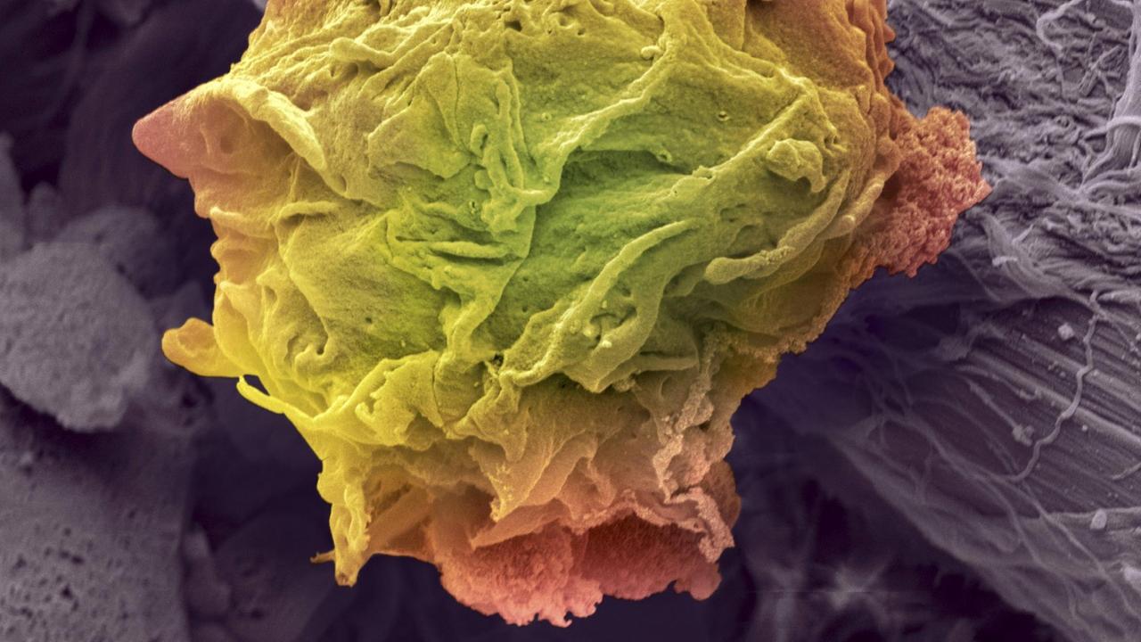 Lymphoma cancer cell SEM Lymphoma cancer cell Coloured scanning electron micrograph SEM of a lym
Lymphdrüsenkrebs, Farbiger Scan einer elektronischen Mikrograpfie Lymphoma cancer cell SEM Lymphoma cancer cell Coloured scanning electron micrograph SEM of a lym
Lymphdrüsenkrebs, Farbiger Scan einer elektronischen Mikrograpfie