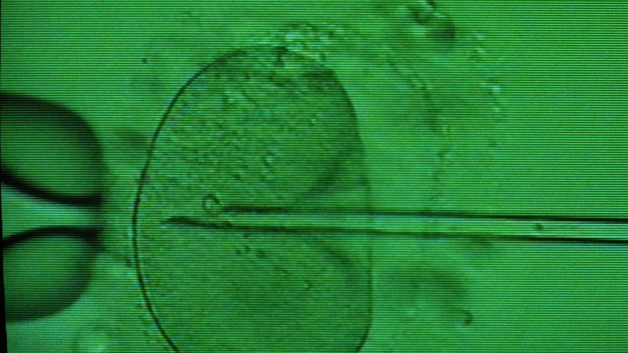 Das Monitorfoto zeigt das Einbringen einer Samenzelle in eine Eizelle mittels Mikropipette unter dem Mikroskop. Das Monitorfoto zeigt das Einbringen einer Samenzelle in eine Eizelle mittels Mikropipette unter dem Mikroskop.