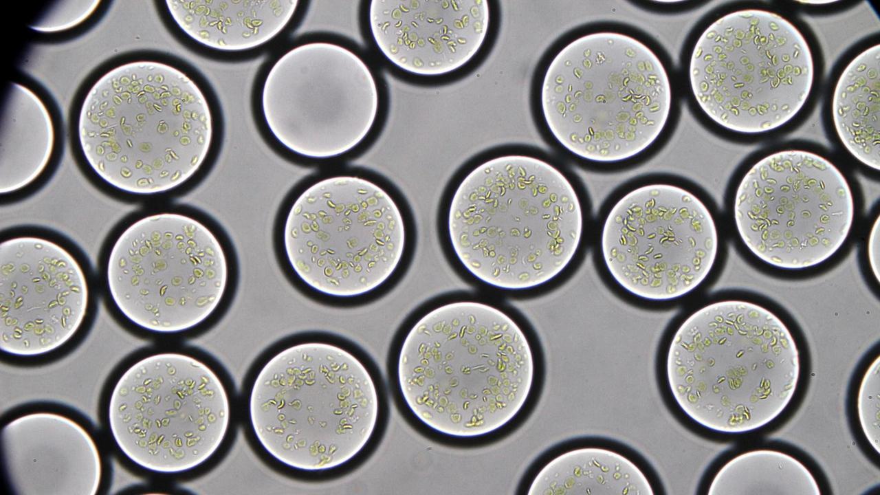 Mikroskopaufnahme von Künstlichen Chloroplasten (Photosynthese-Membrane sind in Tröpfchen eingeschlossen) 