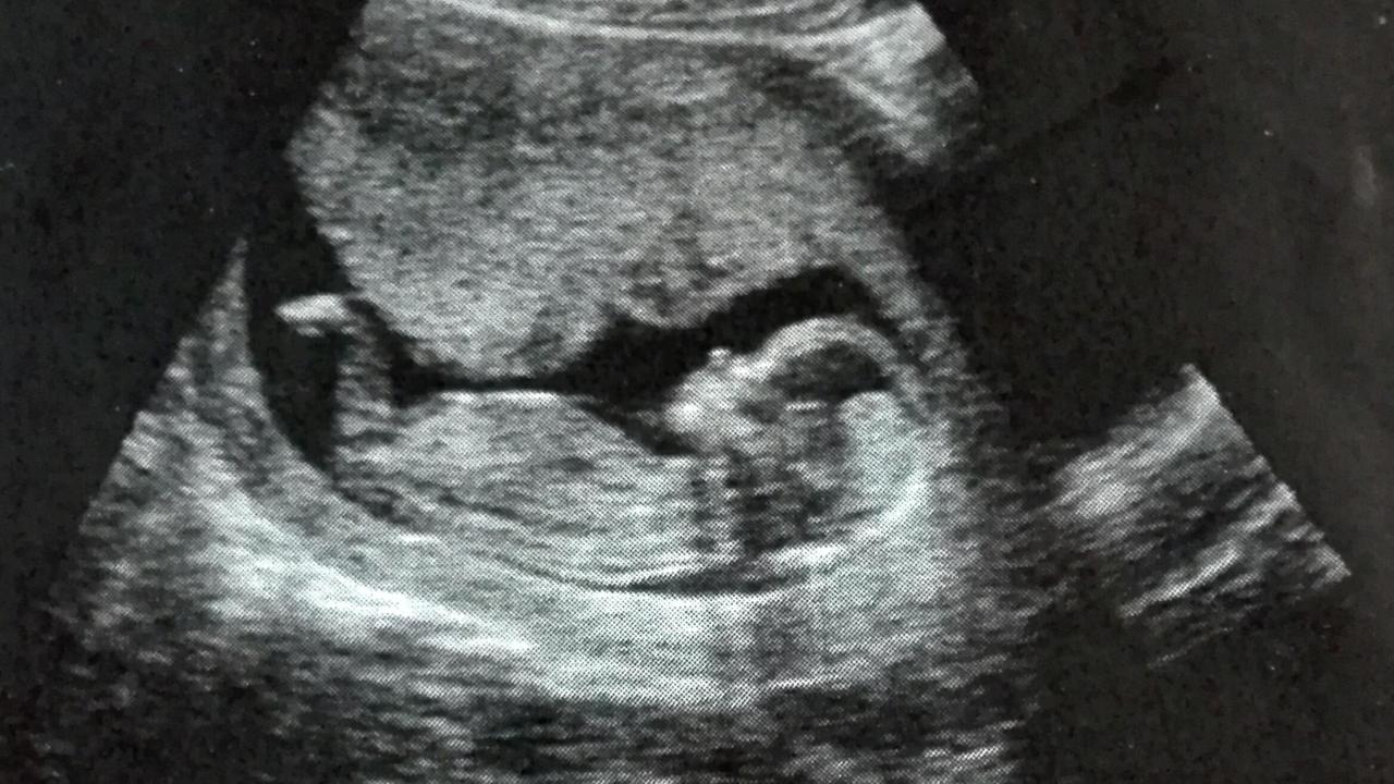 Ein Ultraschallbild. Zu sehen ist das Baby im Mutterleib. Ein Ultraschallbild. Zu sehen ist das Baby im Mutterleib.