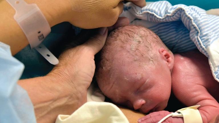Uterus-Transplantation: Das neugeborene Baby kurz nach der Geburt Uterus-Transplantation: Das neugeborene Baby kurz nach der Geburt