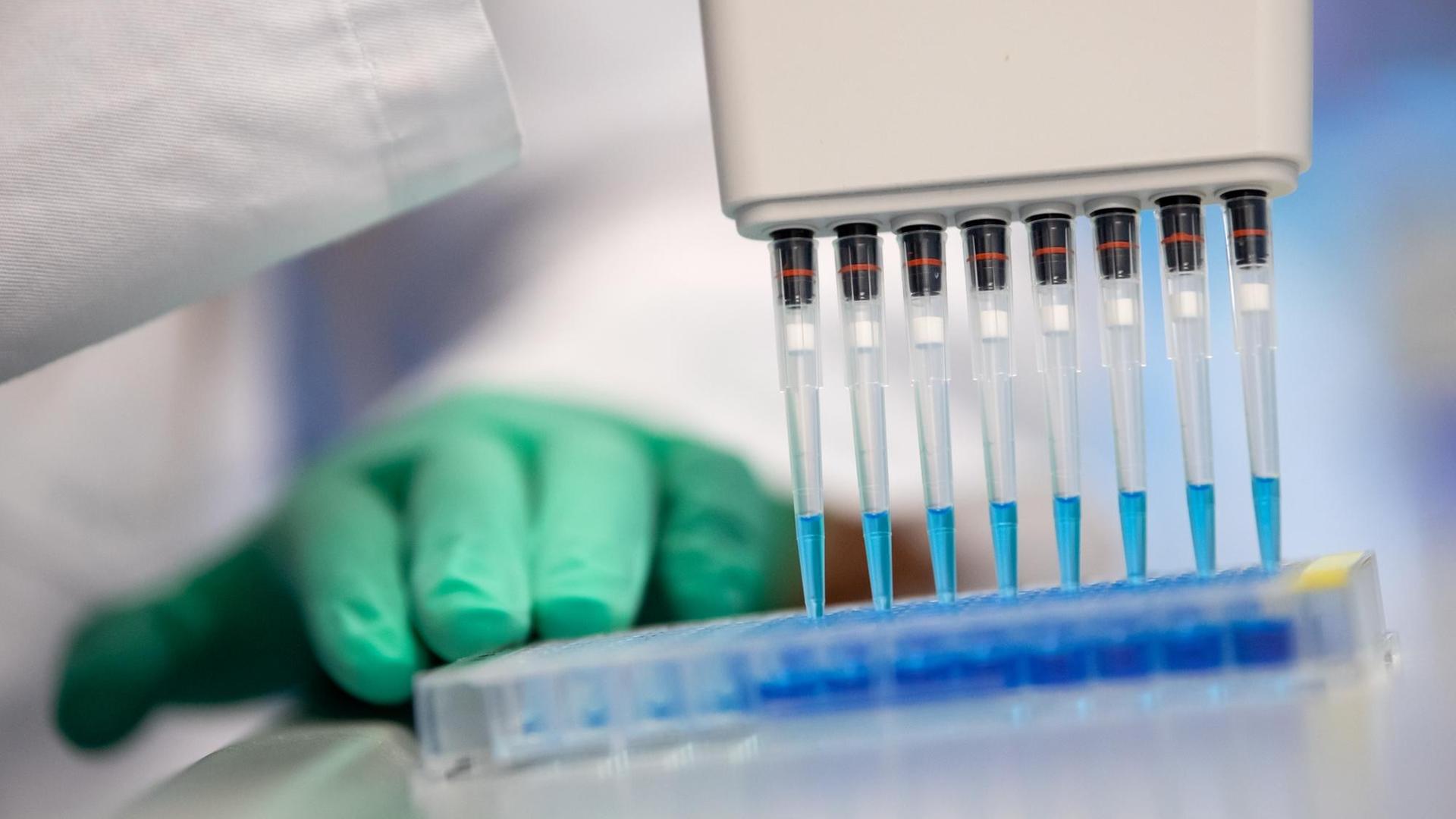 Eine Mitarbeiterin am Institut für Virologie der technischen Universität München (TUM) pipettiert in einem Labor einen Ansatz zum Proteinnachweis. Eine Mitarbeiterin am Institut für Virologie der technischen Universität München (TUM) pipettiert in einem Labor einen Ansatz zum Proteinnachweis.