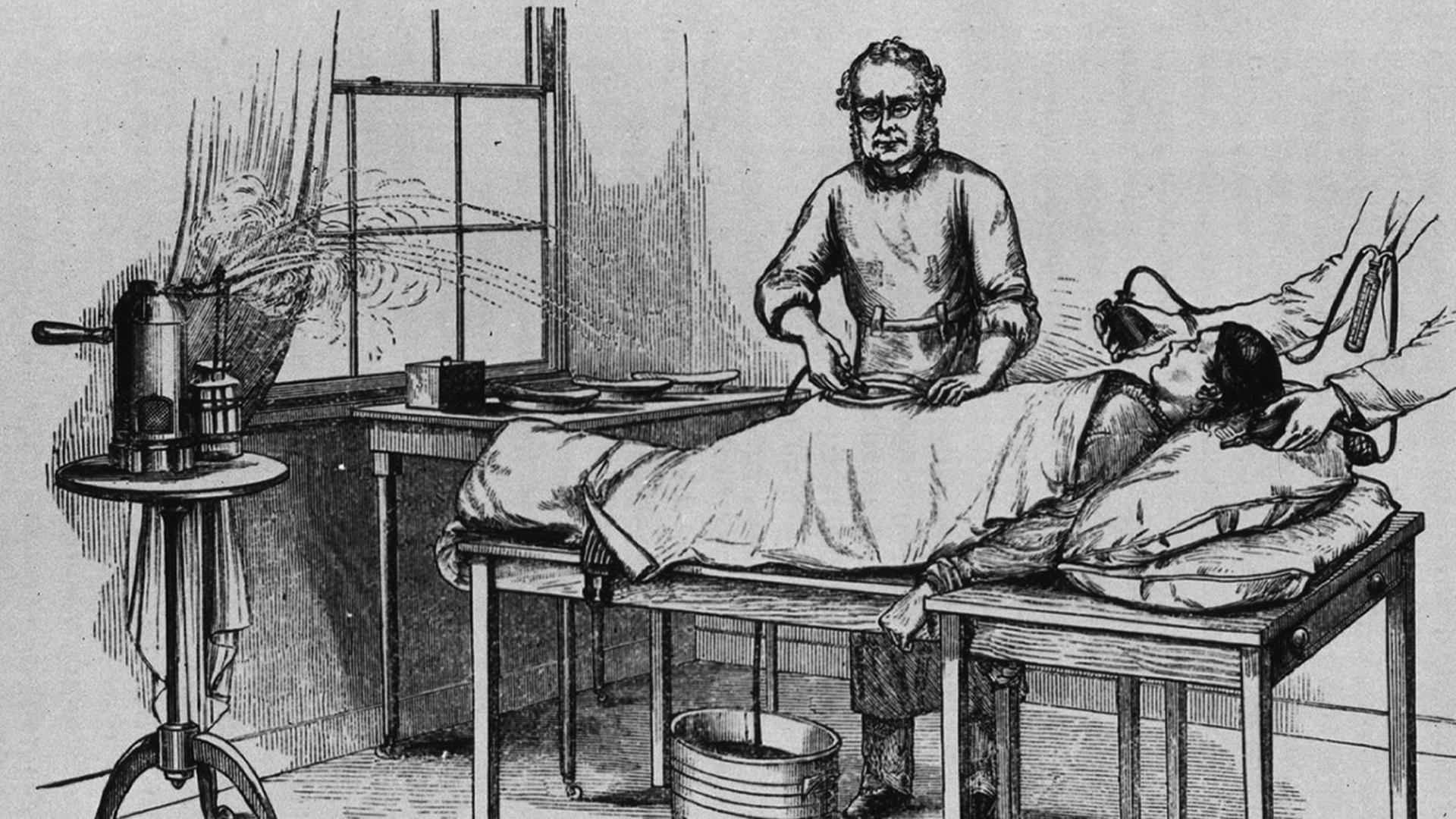 Operation von 1882: Der Chirurg entfernt hier Eierstöcke bei einer weiblichen Patientin Operation von 1882: Der Chirurg entfernt hier Eierstöcke bei einer weiblichen Patientin