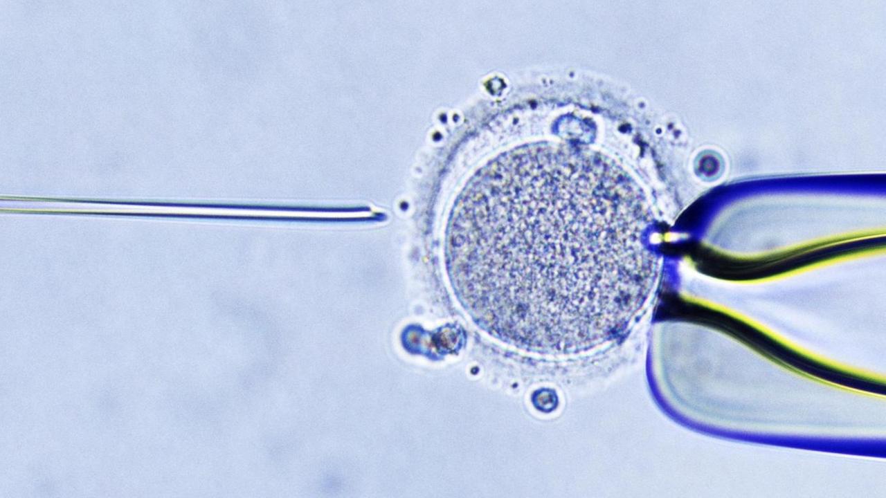 Eine Mikroskopaufnahme einer In-vitro-Fertilisation, die Injektion von Spermium in die Eizelle. Eine Mikroskopaufnahme einer In-vitro-Fertilisation, die Injektion von Spermium in die Eizelle.
