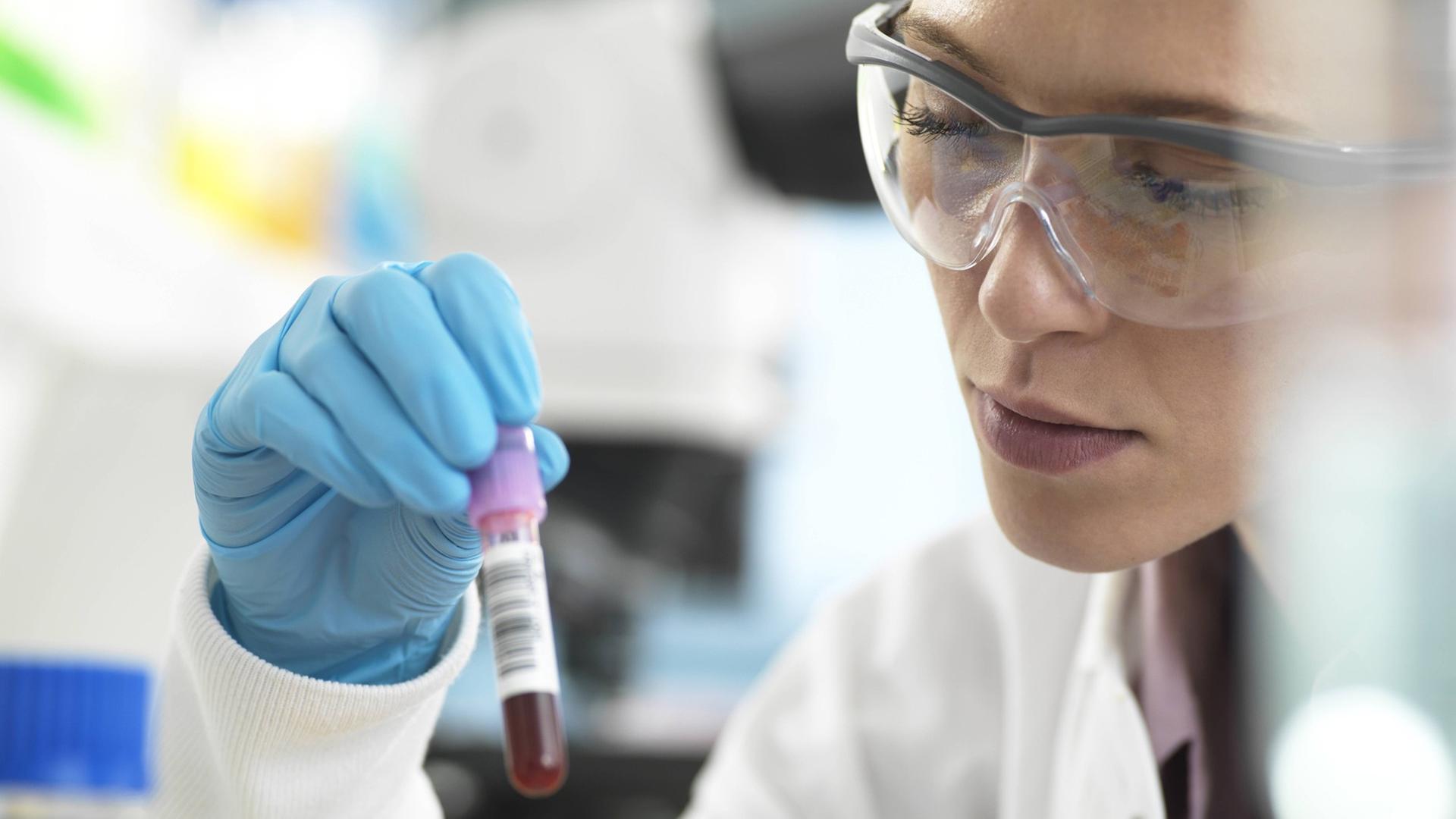 Eine Laborantin hält ein Röhrchen mit Blut in der Hand. Eine Laborantin hält ein Röhrchen mit Blut in der Hand.