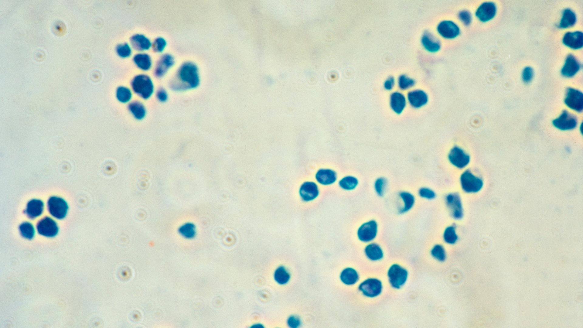 Blaue Pünktchen auf weißem Hintergrund, mikroskopische Aufnahme von Bakterien Blaue Pünktchen auf weißem Hintergrund, mikroskopische Aufnahme von Bakterien