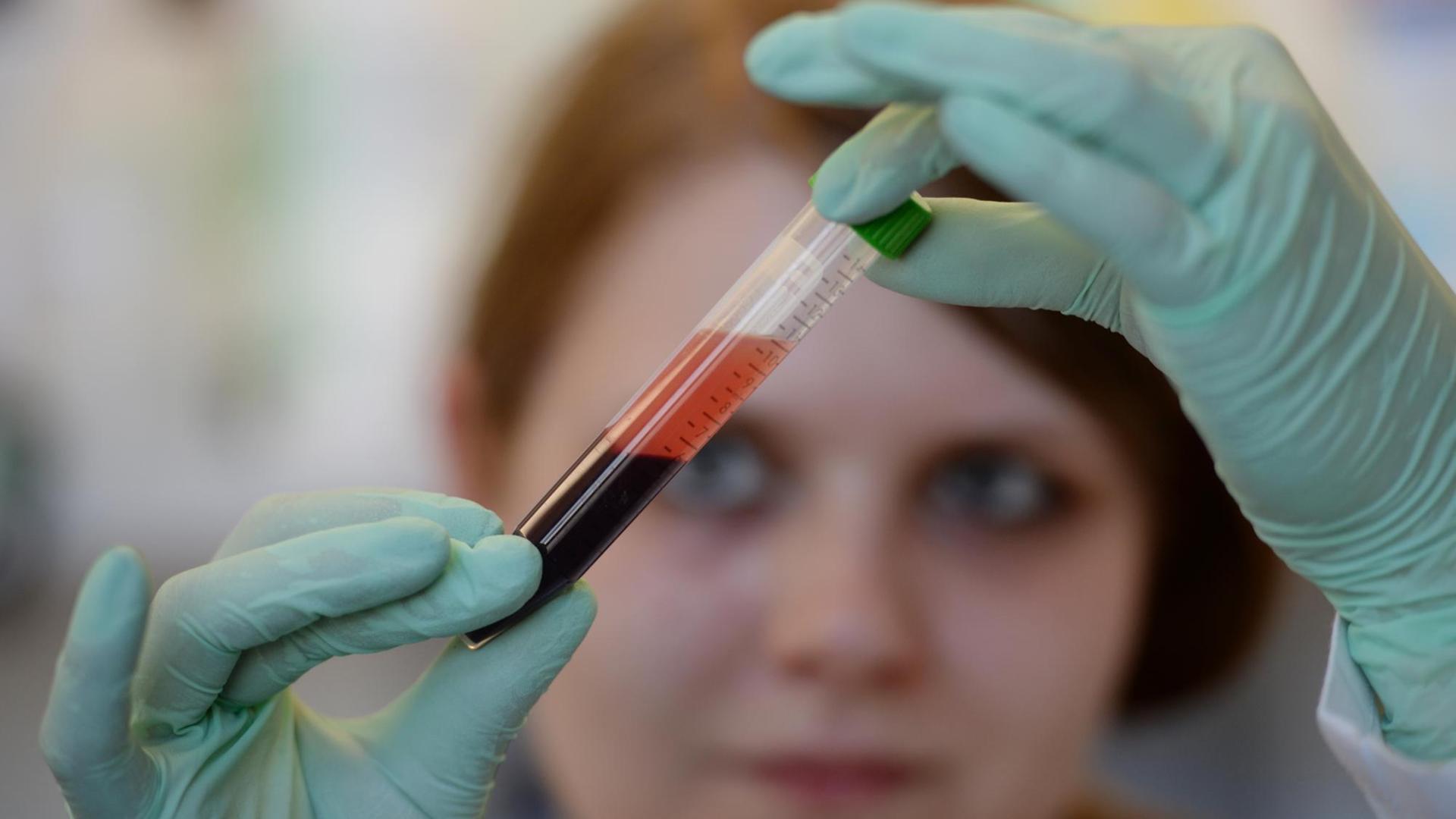 Bei der Firma Lifecodexx wird die Blutprobe einer schwangeren Frau von einer medizinisch-technischen Assistentin analysiert. Das Unternehmen hat den "PraenaTest" entwickelt. Bei der Firma Lifecodexx wird die Blutprobe einer schwangeren Frau von einer medizinisch-technischen Assistentin analysiert. Das Unternehmen hat den "PraenaTest" entwickelt.