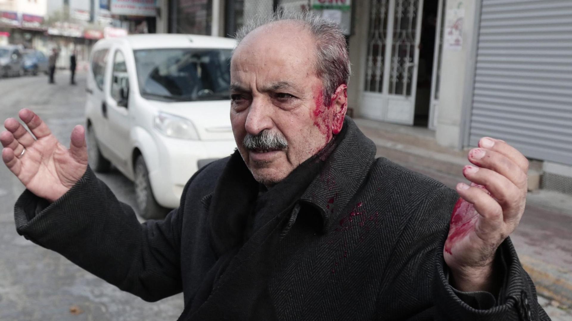 Ein verletzter kurdischer Demonstrant Ein verletzter kurdischer Demonstrant